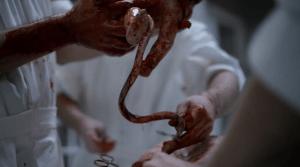 The Knick surgery